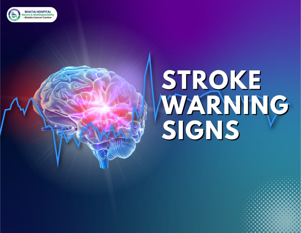 Early signs of stroke